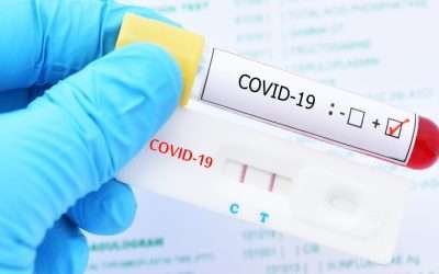 Debe Salud otorgar más pruebas gratuitas anti Covid19: Brenda Valenzuela