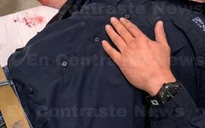 Atacan a agente de Robo de Vehículos