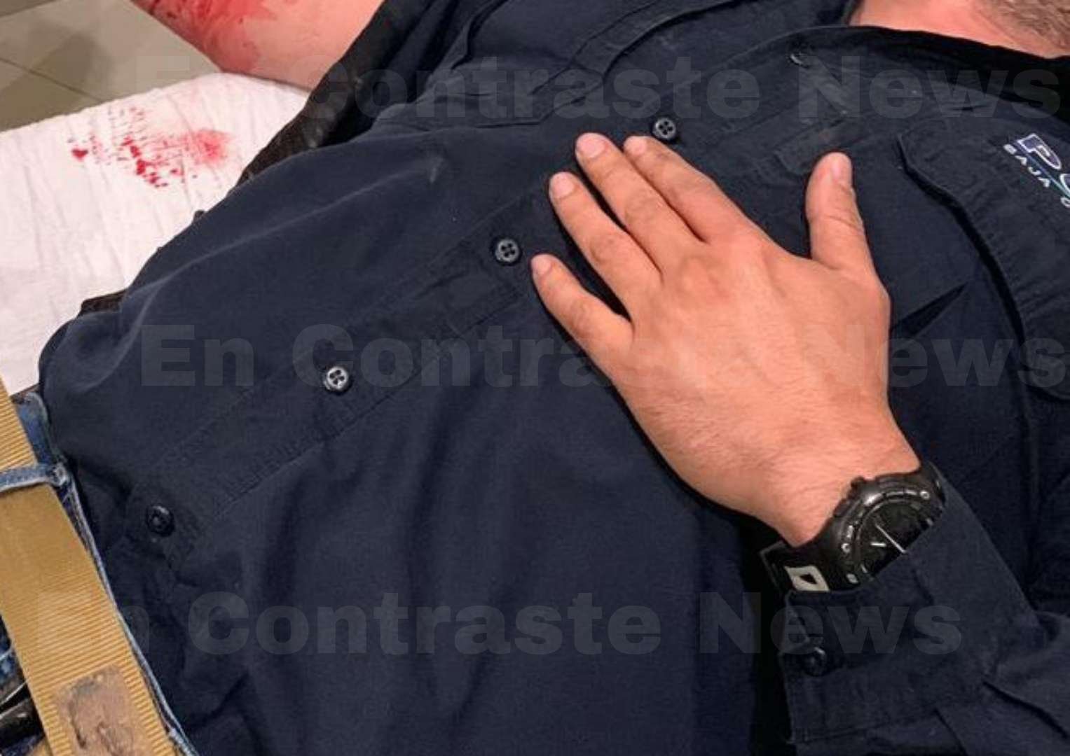 Agente lesionado