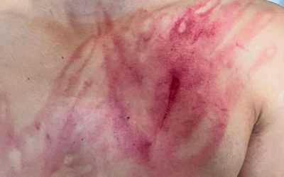 Inicia FGE investigación por menor lesionado en evento de lucha libre