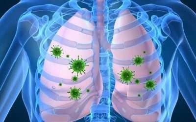 ¿Sabes diferenciar los síntomas de una neumonía y una gripe?