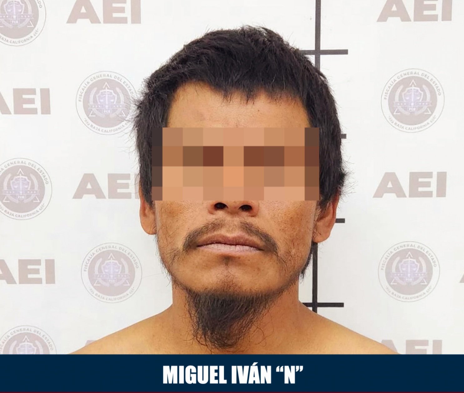 Vinculación por lesiones